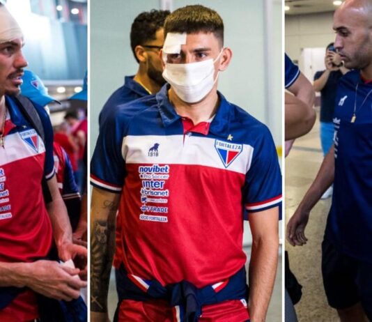 CEO do Fortaleza revela que Escobar teve traumatismo craniano e defende que time não jogue até recuperação