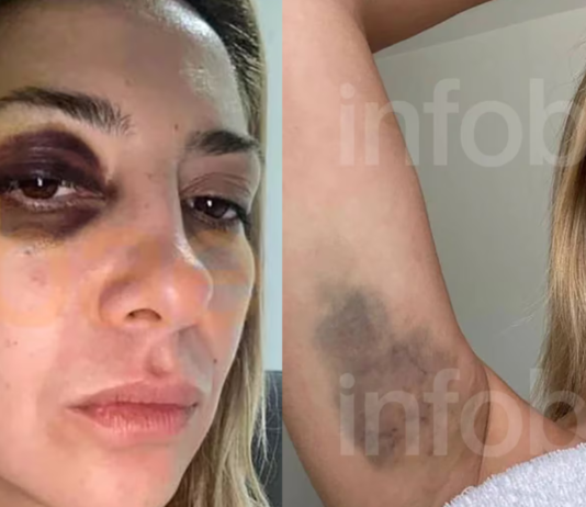 Ex-primeira-dama da Argentina diz que agressões de Fernández começaram em 2016 e o acusa de lesões graves e abuso de autoridade