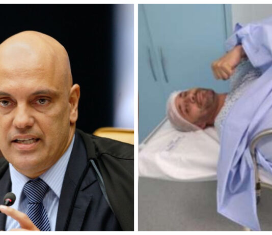 Tomografia feita três dias antes da prisão de Silveira confirma pedra no rim