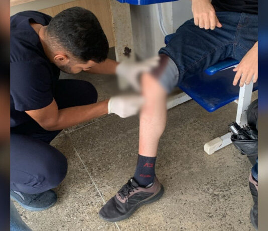 Aluno da UFC é esfaqueado no joelho em tentativa de assalto na proximidades da universidade.