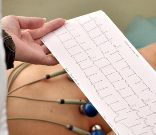 Fortaleza tem 314 mil pessoas à espera de eletrocardiograma