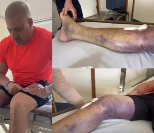 Moraes autoriza saídas temporárias de Daniel Silveira para tratamento