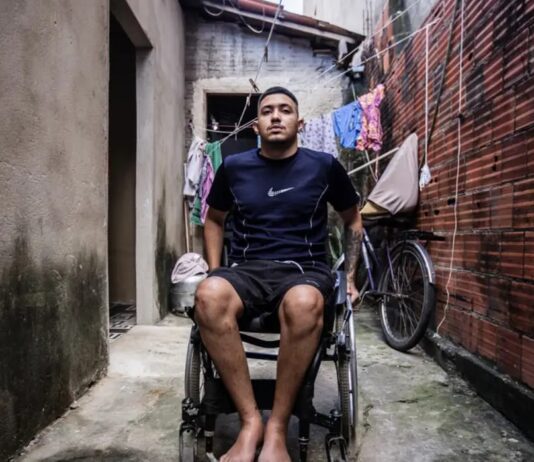 Jovem tratado com polilaminina no Ceará ficou paraplégico ao ser baleado na porta de casa