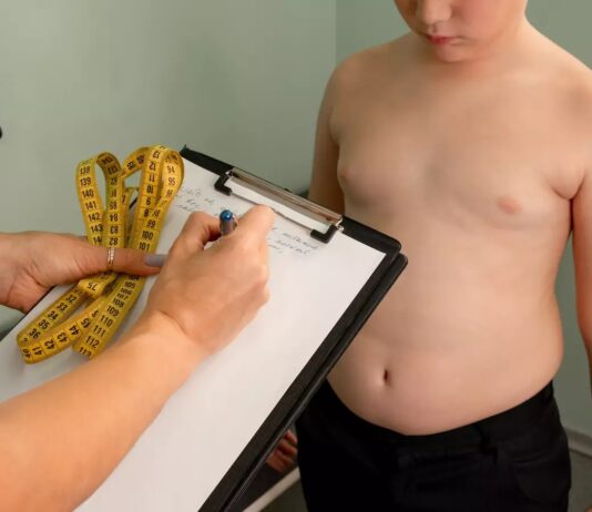 Obesidade infantil atinge 40% das crianças de até 9 anos no Ceará e pode antecipar doenças